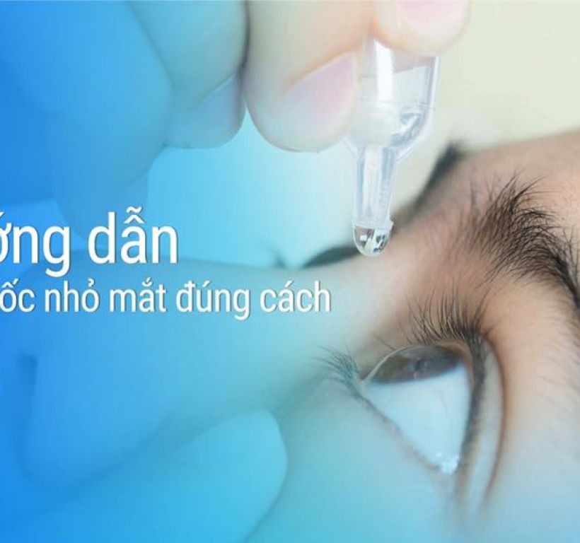 Hướng dẫn tra thuốc nhỏ mắt đúng cách